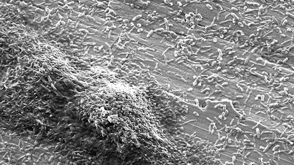 legionella batterio